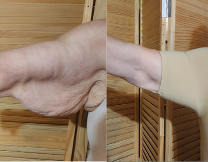 Upper Arm Shaper & Posture Support